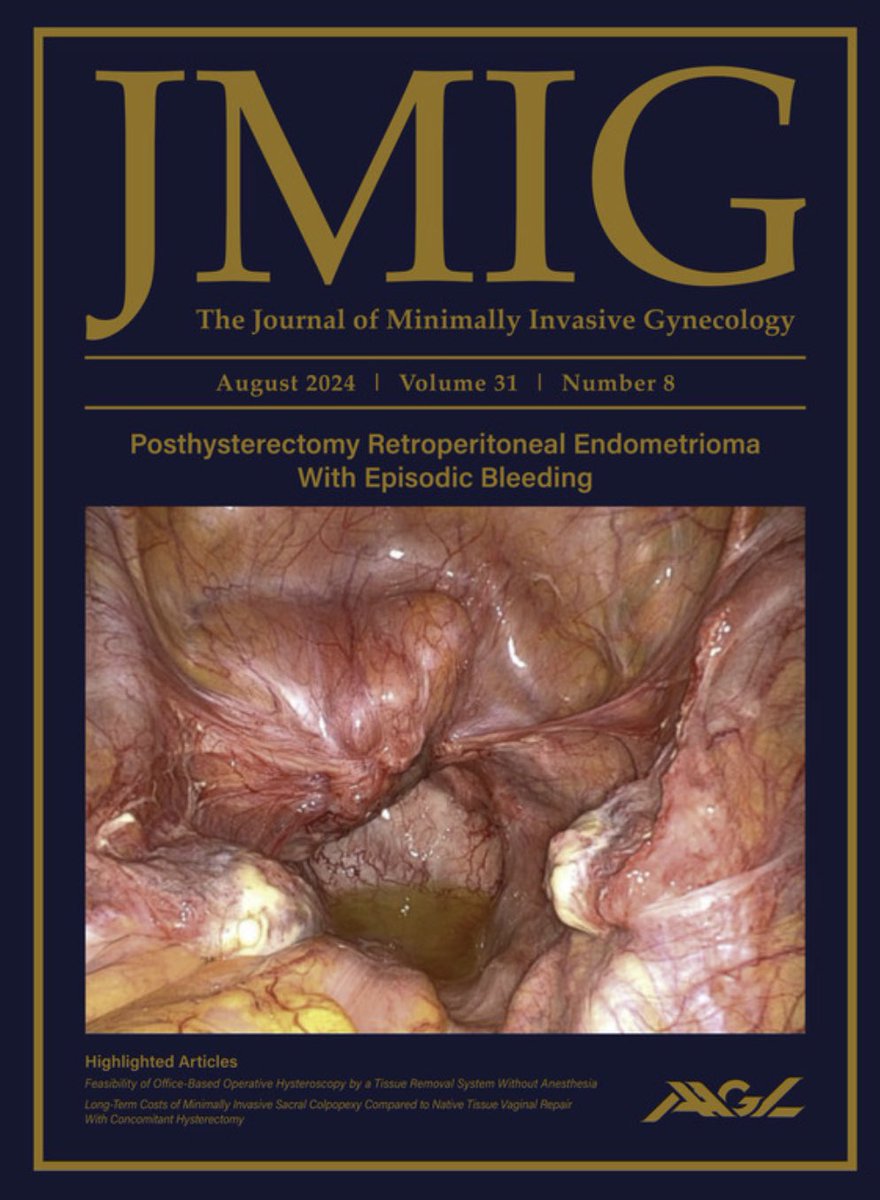 Megan Wasson, DO, FACOG, FACS (@wassonmegan) on Twitter photo This month’s <a href="/AAGLJMIG/">JMIG</a> includes case from #MayoClinicAZ of retroperitoneal #endometrioma presenting with vaginal bleeding after #hysterectomy. Congrats <a href="/MayoClinicSOM/">Mayo Clinic Alix School of Medicine</a> student, Sanju Senthilkumar, on your first publication and cover feature! @mayoclinic <a href="/MayoRadiologyAZ/">Mayo Radiology Arizona</a> This month’s <a href="/AAGLJMIG/">JMIG</a> includes case from #MayoClinicAZ of retroperitoneal #endometrioma presenting with vaginal bleeding after #hysterectomy. Congrats <a href="/MayoClinicSOM/">Mayo Clinic Alix School of Medicine</a> student, Sanju Senthilkumar, on your first publication and cover feature! @mayoclinic <a href="/MayoRadiologyAZ/">Mayo Radiology Arizona</a>