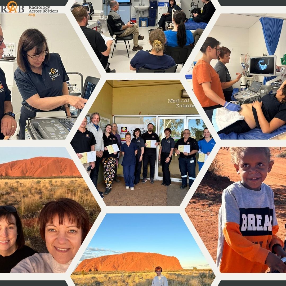 RABchat's tweet image. At Radiology Across Borders, the UNITY First Nations Project aims to improve access to quality imaging services for Australian First Nations People. Check out the highlight video from this event: buff.ly/4cj8EBT  #globalhealthcare #healthcare #firstnationpeople