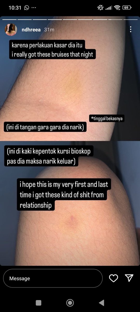 ureciter's tweet photo. GUYS SORRY GUE MAU BANTU TEMEN GUE KLARIFIKASI KRN KEMARIN VIDEONYA KAYANYA SEMPET NAIK DISINI PAS DIA DIKASARIN SAMA LAKINYA https://t.co/sbEAQefcoR