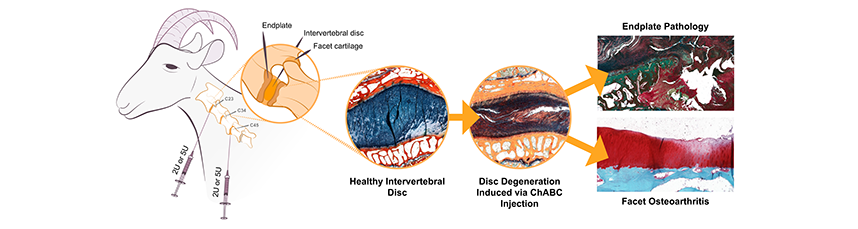 gan_aries's tweet photo. #eCM  Vol 47 -pages-125-141

This study developed a large animal model for spinal motion segment degeneration, revealing correlations between trans-endplate diffusion and disc health. It enhances the translational relevance of research on disc regeneration and repair strategies. https://t.co/p1zAduPWy5