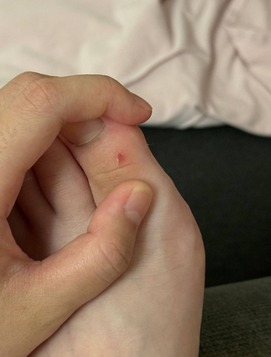 Fleas0r's tweet photo. 穿凉拖磨破了 哭哭 #挠脚心 #挠痒痒 #tickle #tk #足控 #女大学生 #裸足 #怕痒 https://t.co/yMn1IFMc0q