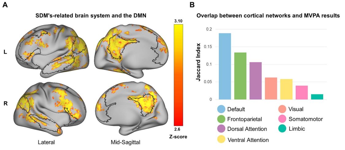 Shahar Arzy (@shahararzy) on Twitter photo What makes life significnat? our new work at Cerebral Cortex with <a href="/RotemMo/">Rotem Monsa</a> and <a href="/Amnon_Dafni/">Amnon Dafni-Merom</a> shows how central is self-reflection and that the underlying brain mechanisms are different. see more shorturl.at/KcloC What makes life significnat? our new work at Cerebral Cortex with <a href="/RotemMo/">Rotem Monsa</a> and <a href="/Amnon_Dafni/">Amnon Dafni-Merom</a> shows how central is self-reflection and that the underlying brain mechanisms are different. see more shorturl.at/KcloC
