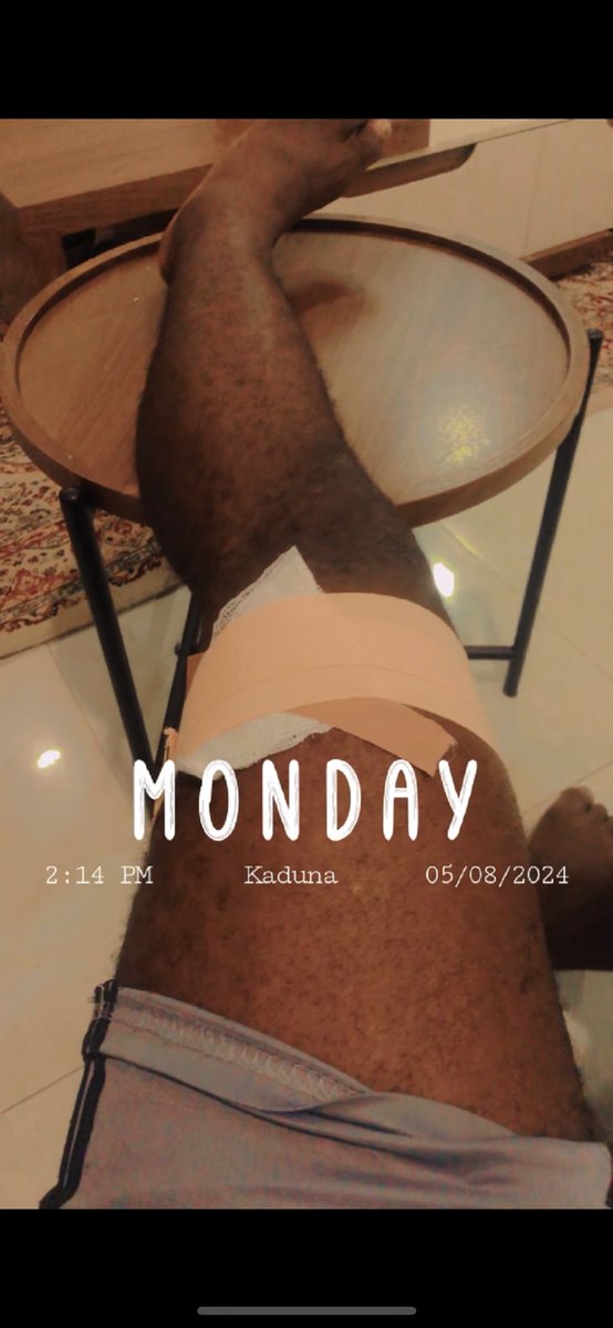 character__9's tweet image. I was shot by an Officer of the @NigerianPolice in kaduna standing in front of my house (not protesting).. no sympathy from him as he walked away after shooting. Is this a new training?@NigeriapolicePR . Thanks to men of @HQNigerianArmy for assisting me

Mistakenly out now zaria