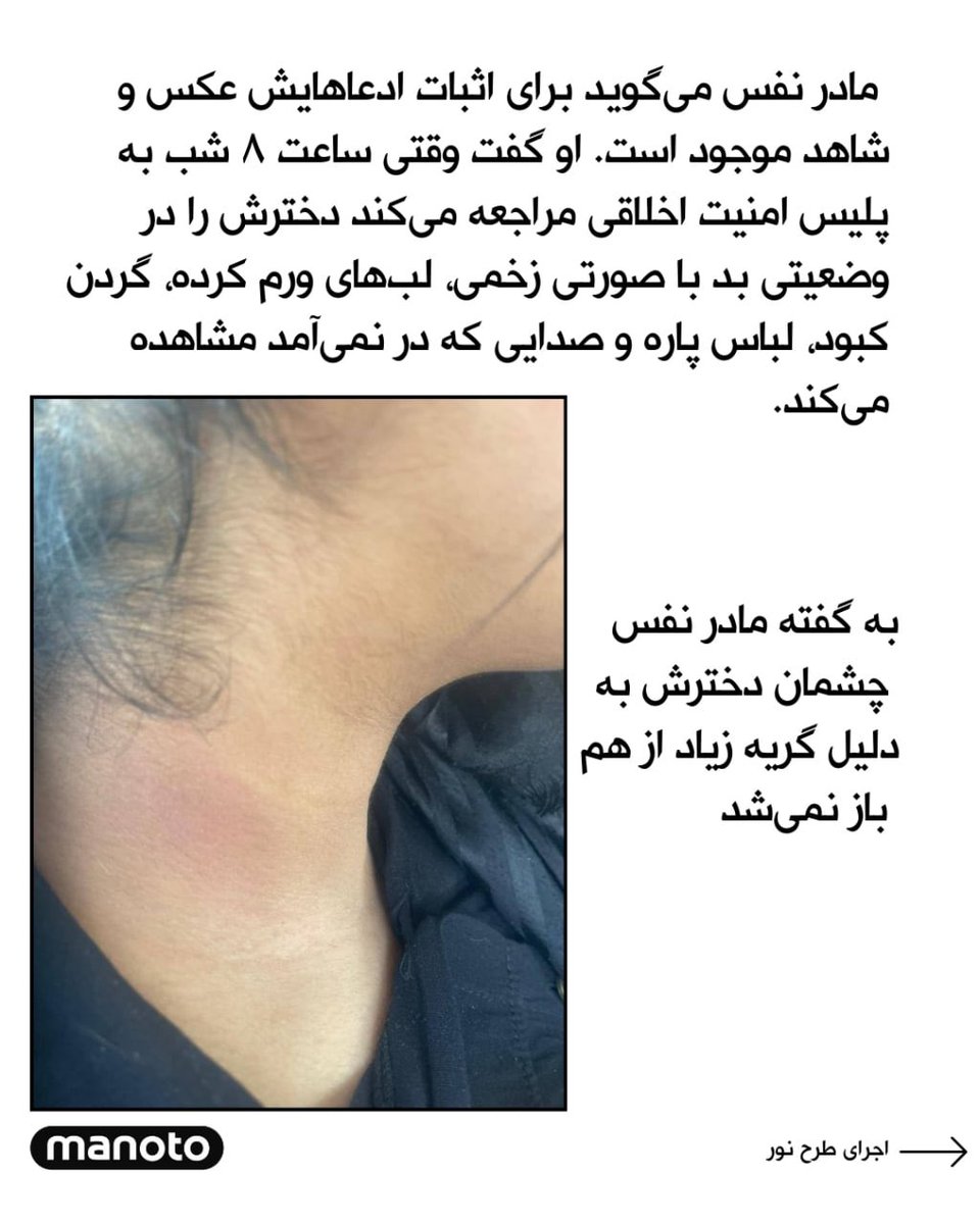 atheistcyrus's tweet image. #ایران_اشغالی جاییست که دختربچه‌هایش از ترس گشتاپوی اسلامی پنهان، و سپس دستگیر شده و به دست ماموران حکومتی، وحشیانه شکنجه می‌شوند! در ایران اشغالی، رژیم جوان بی‌گناهی را دار می‌زند تا از ملت ایران، انتقام شکست تحقیرآمیز خود از دشمنان قدرتمندش را بگیرد! میان احساسات یهودیان در…