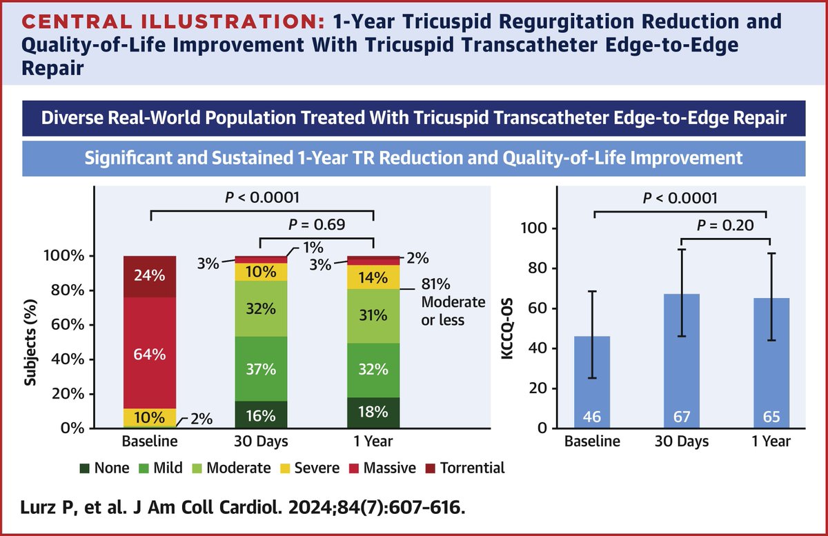 In the bRIGHT study, tricuspid #TEER with #TriClip is safe and effective through 1-yr for significant TR in a real-world population bit.ly/4bEVbEE

#JACC #vhdTR <a href="/vonBardelebenRS/">Univ.-Prof. Dr. Ralph Stephan von Bardeleben</a> <a href="/kp_rommel/">Karl-Philipp Rommel</a>