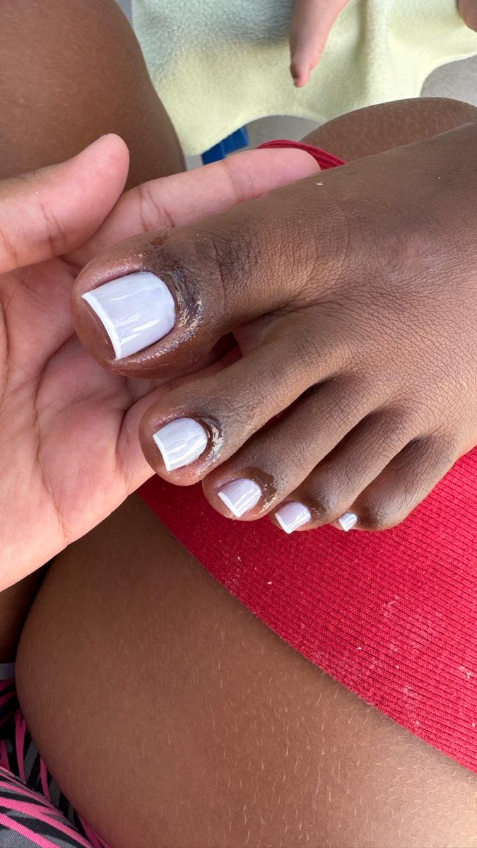 Vou colocar a promoção de $12,00 francesinha 👣🤞🏻😍 (21)99231-2416 ..