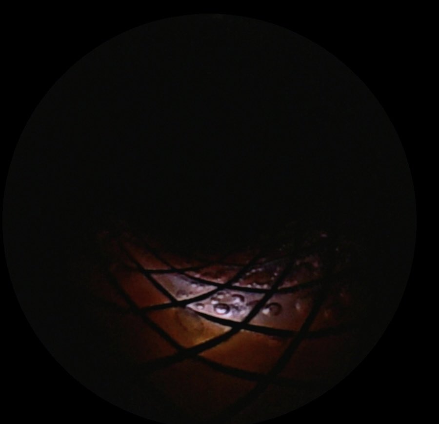 EndoscopiaRespiratoria_HUB tweet media