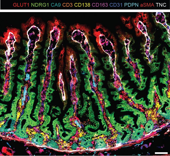 Happy to share our new paper: A spatial expression atlas of the adult human proximal small intestine, out today in <a href="/Nature/">nature</a>: nature.com/articles/s4158…. We describe the zonated expression patterns of cells along and across the villus axis in the healthy adult small intestine.