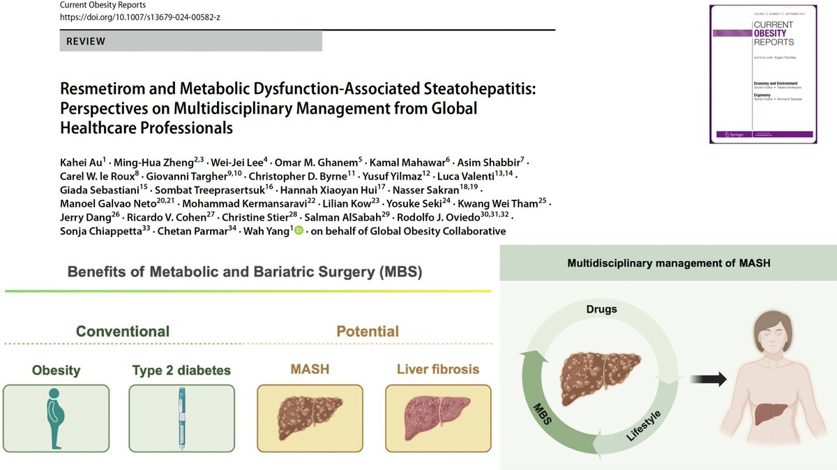 *⃣Pleased to coauthor this viewpoint on #resmetirom and #MASLD with the Global #Obesity Collaborative
🟩Focus on a comprehensive treatment  for #metabolic health
👉link.springer.com/article/10.100…

<a href="/McGill_DOM/">McGill_DOM</a> <a href="/CASLupdates/">CASL</a> <a href="/SpringerNature/">Springer Nature</a> <a href="/FRQS1/">FRQ - secteur Santé</a> <a href="/RIMUHC1/">Research Institute of the MUHC (The Institute)</a> <a href="/cusm_muhc/">Centre universitaire de santé McGill</a> <a href="/ObesityCan/">Obesity Canada</a> <a href="/rrcmdo/">Réseau CMDO</a>