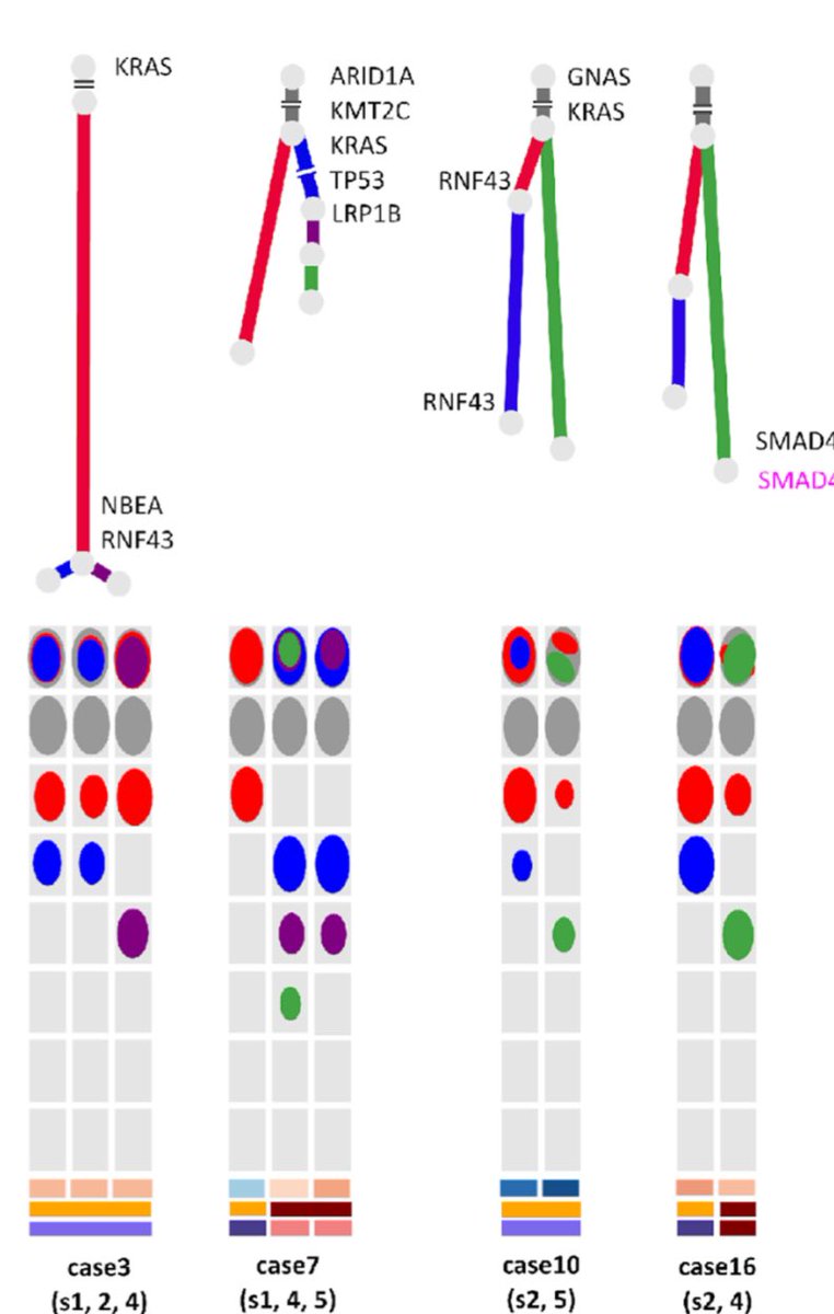 Aiims1742's tweet photo. New preprint from @dkfchang @nigeljamieson & colleagues 
Clonal evolutionary analysis reveals patterns of malignant transformation in #PancreaticCancer from Intraductal Papillary Mucinous IPMN Neoplasms (IPMN)
https://t.co/01bDlDtZ1A
Phylogenetic analysis identifies two distinct evolutionary trajectories in the multistep progression of IPMNs to pancreatic cancer: one driven by a single ancestral clone, and another involving multiple independent ancestral clones.