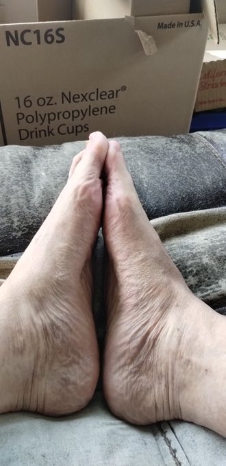 Anybody want to rub my ugly feet? https://t.co/dvSOSjn5gH https://t.co/Za65kOoIIW