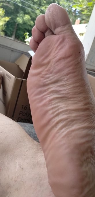 Anybody want to rub my ugly feet? https://t.co/dvSOSjn5gH https://t.co/Za65kOoIIW