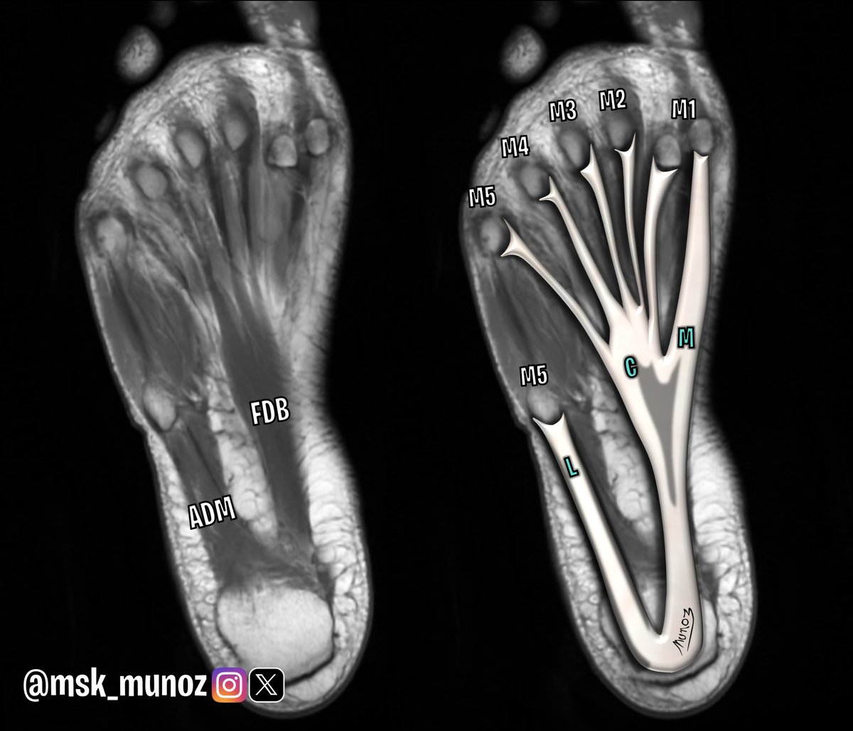 JP Munoz • MSK tweet media