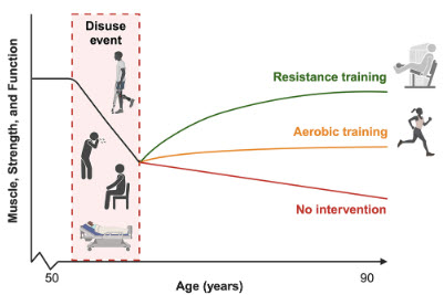 Stuart Phillips (he/him) (@mackinprof) on Twitter photo Mitigating disuse-induced skeletal muscle atrophy in ageing: Resistance exercise as a critical countermeasure pubmed.ncbi.nlm.nih.gov/39106083/
Great work from <a href="/james_mckendry/">James McKendry, Ph.D.</a> <a href="/GiuliaLColetta/">Giulia Coletta</a> <a href="/ChanghyunLim1/">Changhyun Lim</a> <a href="/nunesea/">Everson Nunes</a>
#prehab #rehab #sarcopenia #aging #muscle Mitigating disuse-induced skeletal muscle atrophy in ageing: Resistance exercise as a critical countermeasure pubmed.ncbi.nlm.nih.gov/39106083/
Great work from <a href="/james_mckendry/">James McKendry, Ph.D.</a> <a href="/GiuliaLColetta/">Giulia Coletta</a> <a href="/ChanghyunLim1/">Changhyun Lim</a> <a href="/nunesea/">Everson Nunes</a>
#prehab #rehab #sarcopenia #aging #muscle