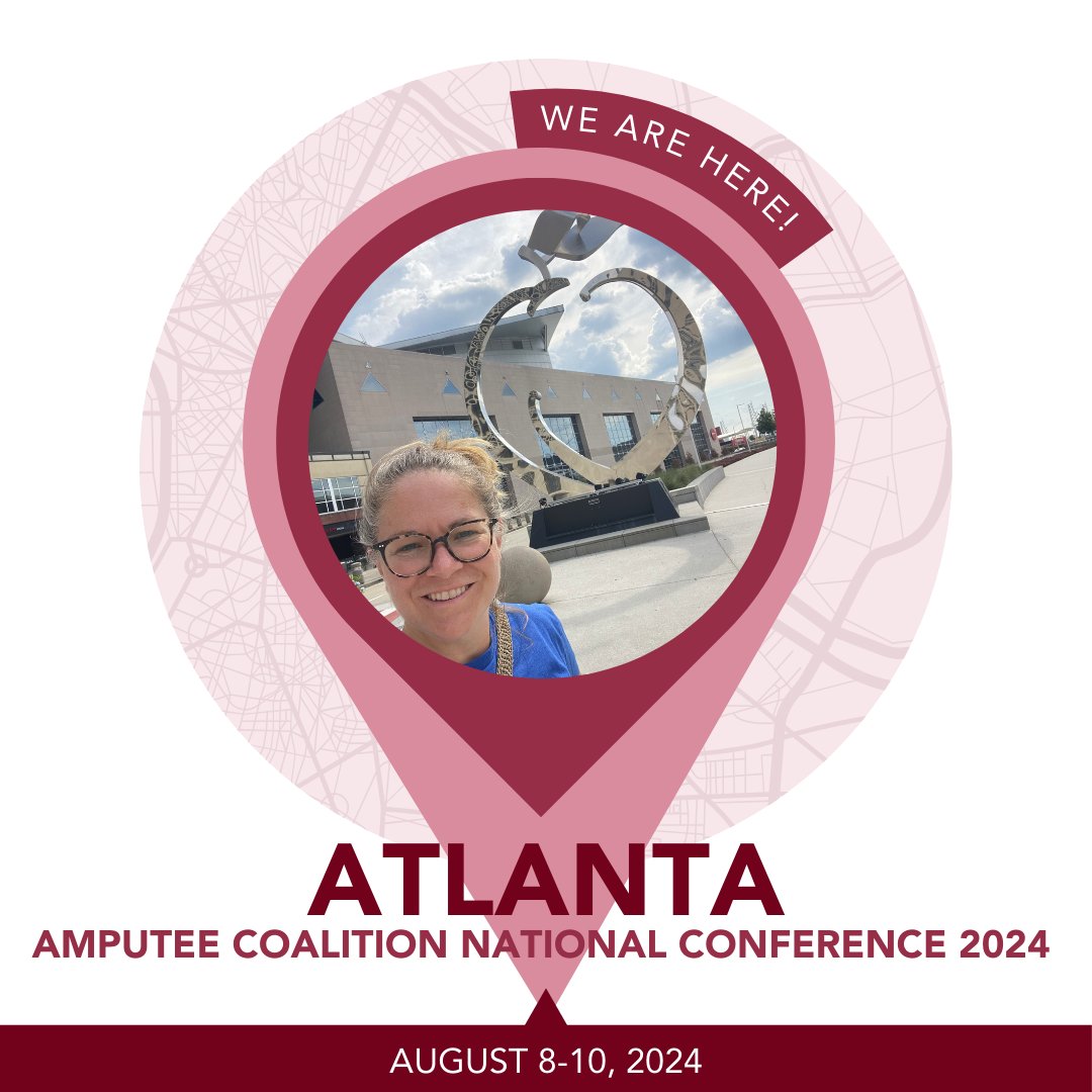 helphopeliveorg's tweet photo. Today we're enjoying #atlanta and getting ready to connect with @AmputeesUSA for the Celebrating Connection #ACNC24 conference! We are thrilled to be able to share how Help Hope Live can help the amputee community fundraise for the things they need and deserve. #amputeecoalition https://t.co/IOJyLENa36
