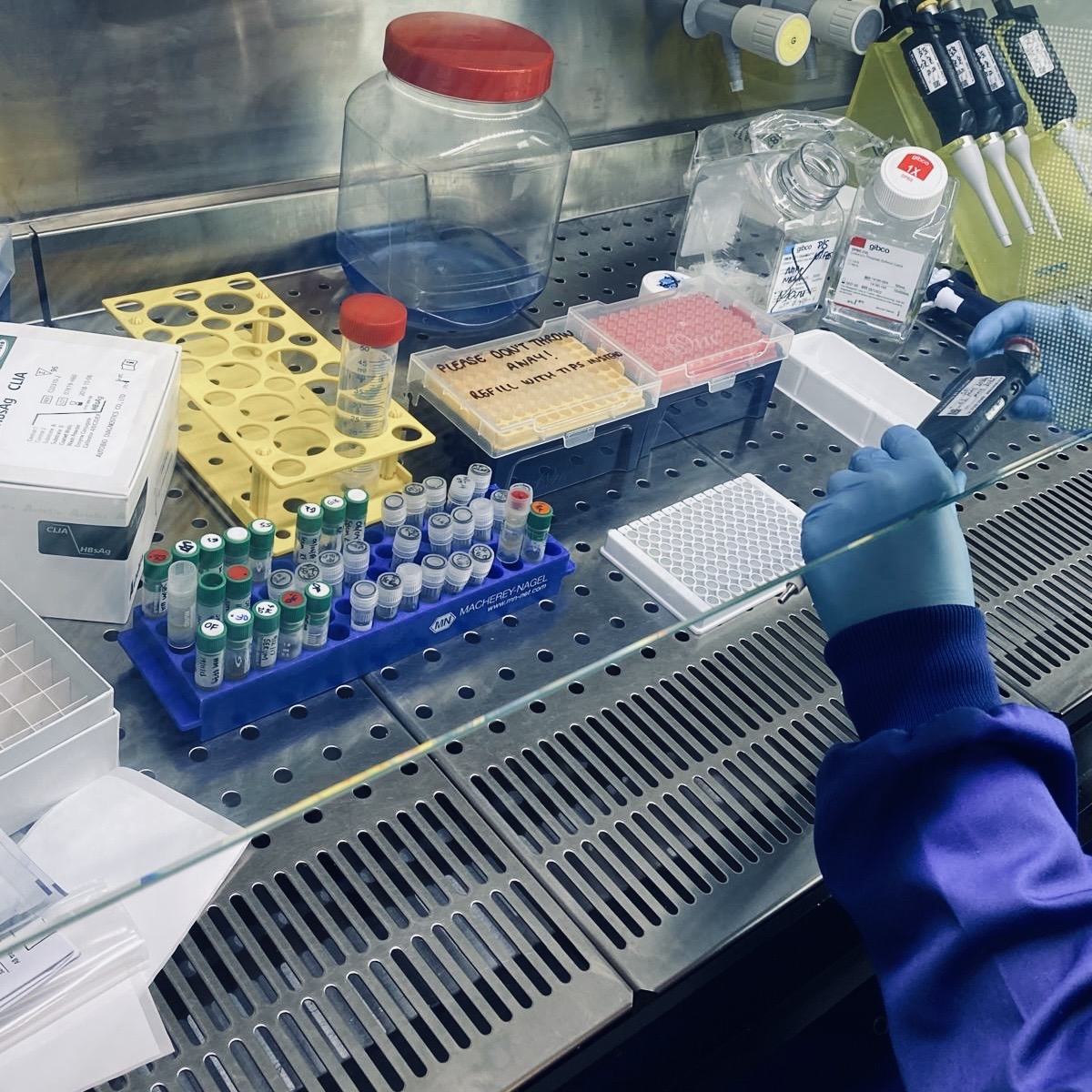 The Roger Williams Institute of Liver Studies (@inst_of_liver) on Twitter photo We're thrilled to announce that the #RogerWilliamsLegacyGrant 2024 has been awarded to Dr Laura Pallett and her project ‘Living off the Land: Uncovering the metabolic preference of liver-resident T-cells’ at <a href="/iit_ucl/">IIT</a> <a href="/uclmedsci/">UCL Faculty of Medical Sciences</a> 👏👏
Congratulations <a href="/ljpally19/">Laura Pallett</a> & team, we're We're thrilled to announce that the #RogerWilliamsLegacyGrant 2024 has been awarded to Dr Laura Pallett and her project ‘Living off the Land: Uncovering the metabolic preference of liver-resident T-cells’ at <a href="/iit_ucl/">IIT</a> <a href="/uclmedsci/">UCL Faculty of Medical Sciences</a> 👏👏
Congratulations <a href="/ljpally19/">Laura Pallett</a> & team, we're