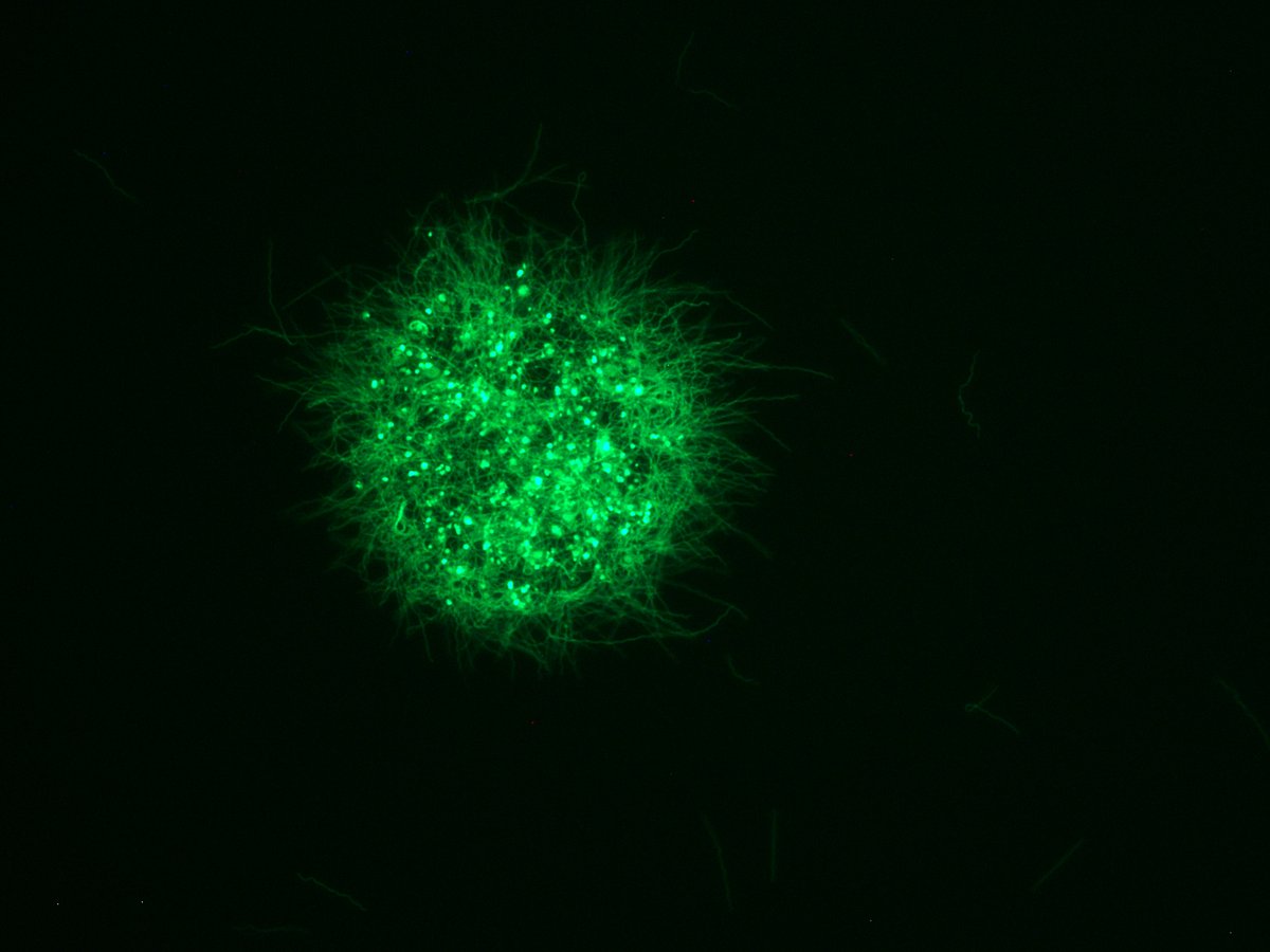 Transforming #Borrelia #burgdorferi #bacteria into vibrant, green fluorescing microorganisms looks amazing! The perfect tool for #tick-#host-#pathogen interaction studies. 😎 #GeneticTransformation #Borreliosis #Infectious #Diseases 💚🔬
