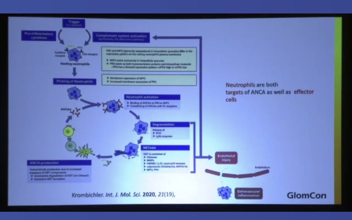 jopelina's tweet image. Amazing explanation of ANCA vasculitis by @kidneypathology Finally understood #NETosis @GlomCon @GlomConILA #GlomConHawaii