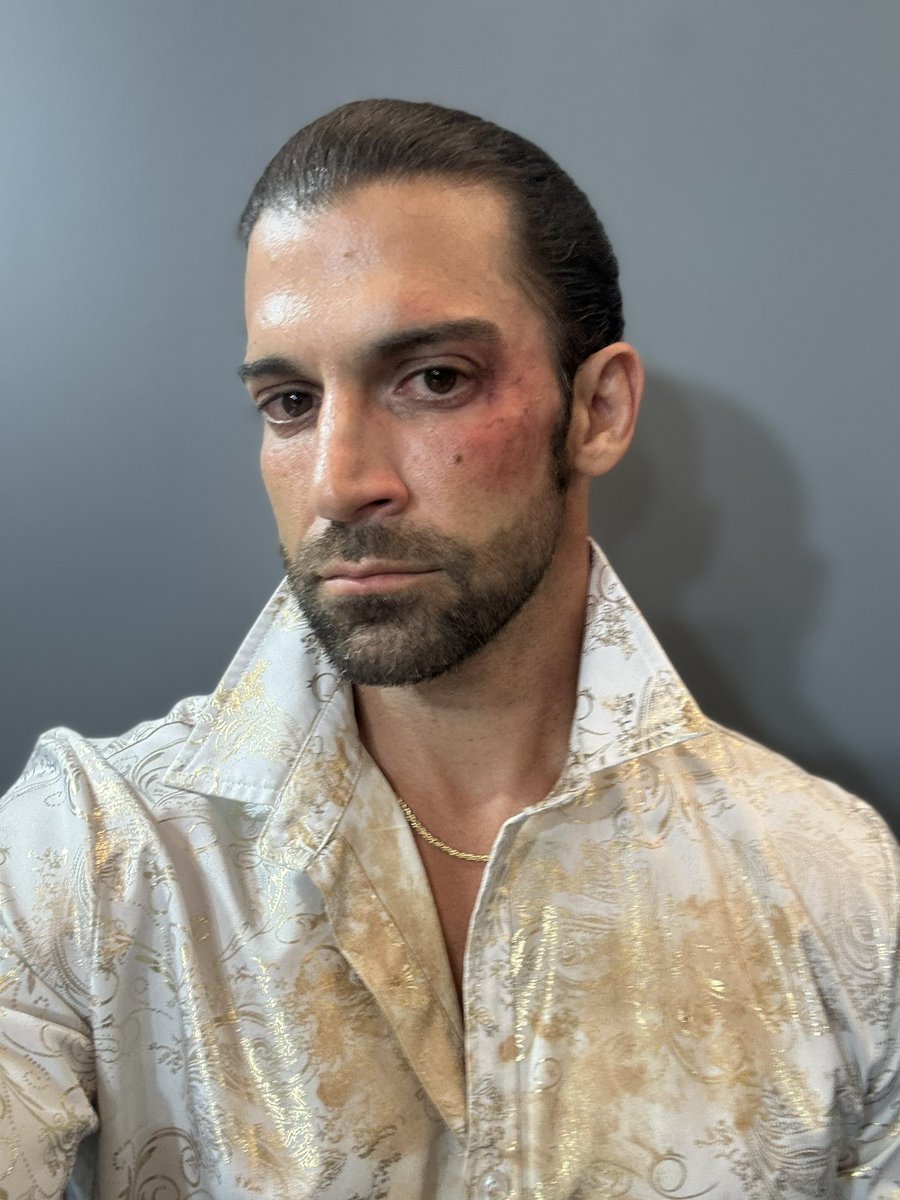 MrStoneWWE's tweet photo. I was hesitant to post this cause some would call it embarrassing. 

Not me. 

As a leader (w/ Ava) of NXT I have to set examples and to ensure nothing like this happens again I am always willing to share my story. 

Retweet so the world sees the monster that Stevie Turner is. https://t.co/HaFUTeQWtL