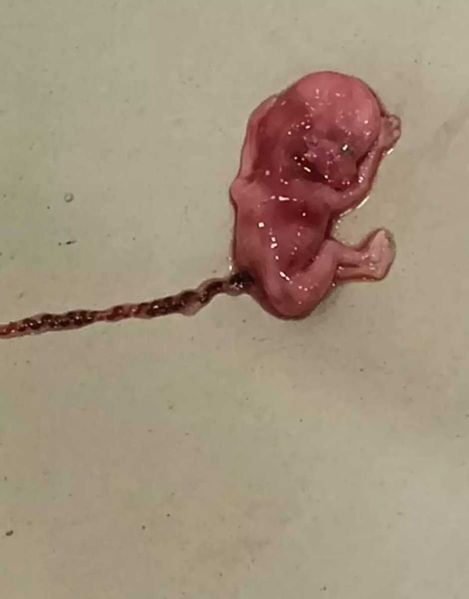 Abhishek Chhipa (@abhishe95054369) on Twitter photo 