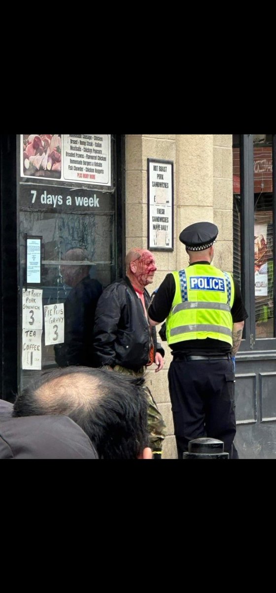 This is my mate John Potter.
He's from Winchester.
We was walking down the road when we was set upon by transexuals who had congregated at the bottom of the road clearly looking for bother. John asked one for a fag and they misinterpreted what he said.
Starmers to blame.