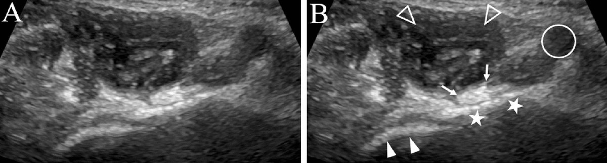 Journal Ultrasound tweet media