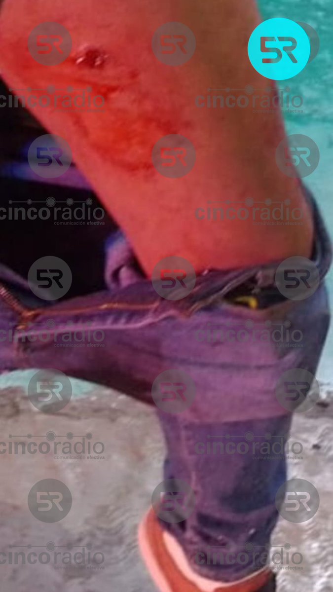 laredcincoradio's tweet photo. 🩸🔫 || Una pareja fue baleada en el “Mirador de las Brujas” en Temetzontla, Panotla, Tlaxcala, durante un intento de asalto. Un joven de 29 años fue herido de bala y la mujer recibió un cachazo en la cabeza. Ambos fueron ingresados a un hospital. #Temetzontla #Asalto #Violencia #NoticiasTlaxcala #Emergencia