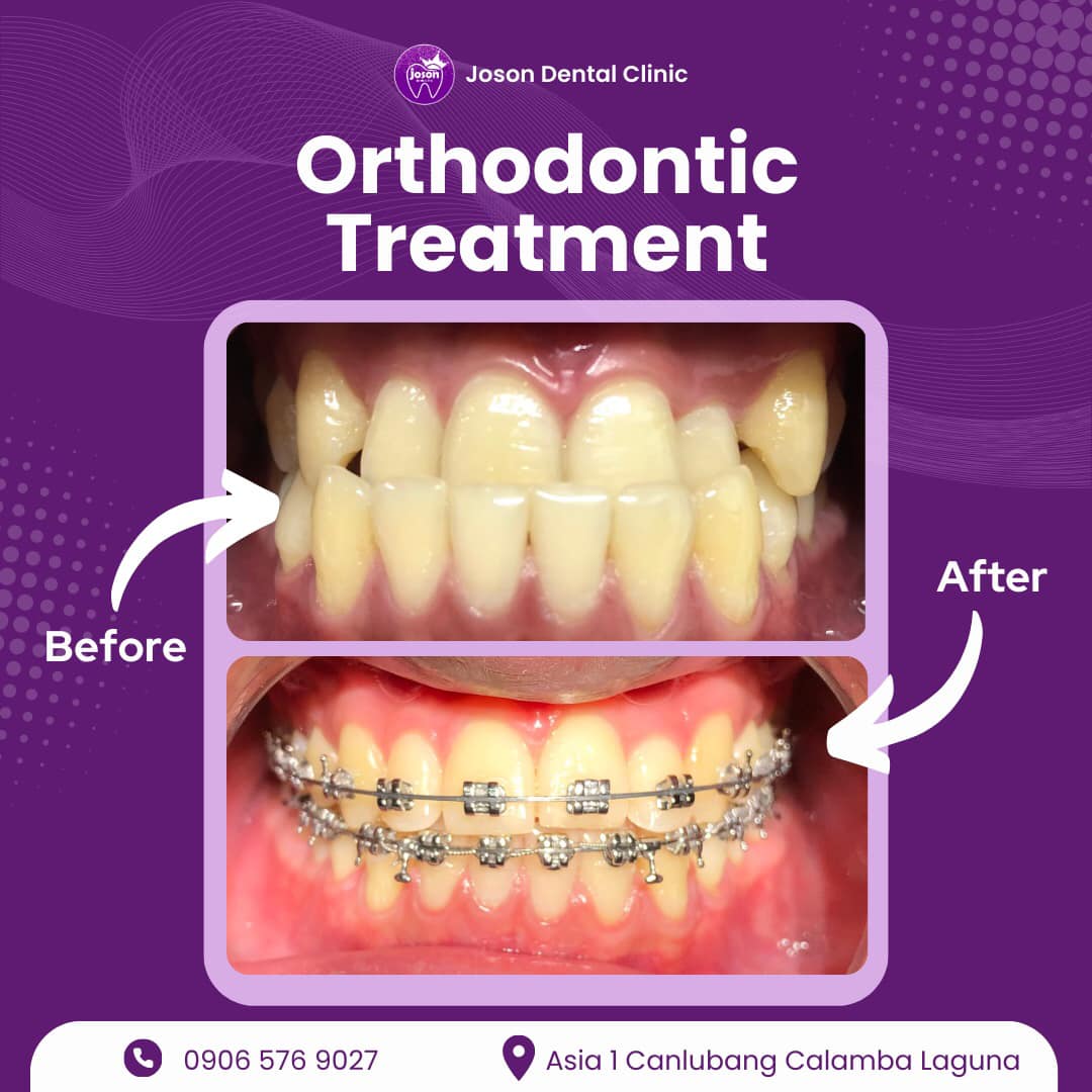 ababatph's tweet image. We provide comprehensive care to our patients. 
PROBLEMS WITH YOUR TEETH??  WE HAVE A SOLUTION FOR YOU!!
OUR PLANS INCLUDE: #dental #teethproblem cebudentalimplants.com/contact