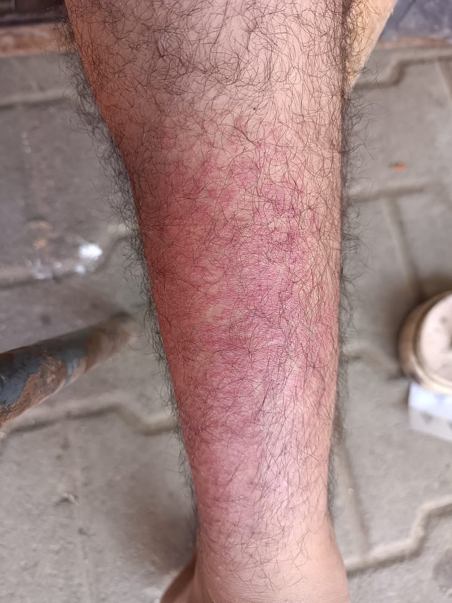 HIBA🍉|| Gaza's daughter🇵🇸 tweet media