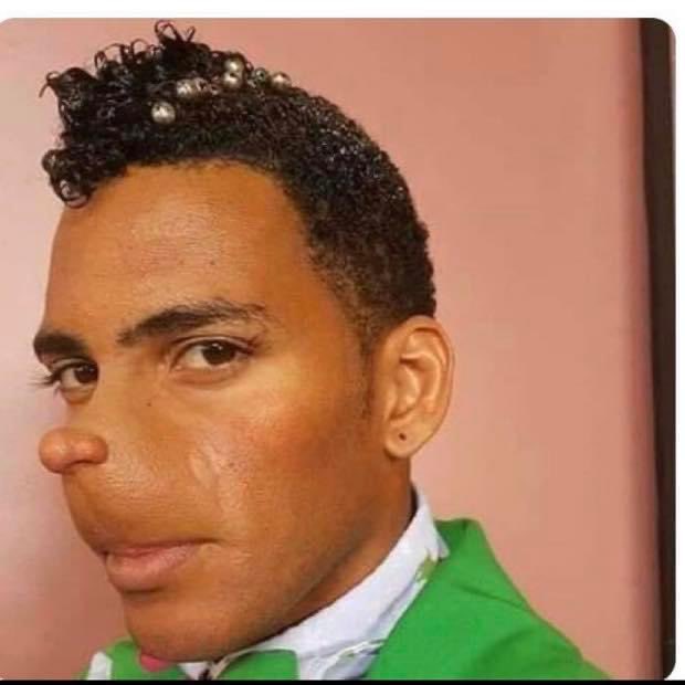 MexicoMagico's tweet photo. Yo después de hacerme la rinoplastia de $3,500 https://t.co/wcCCHPx3rJ