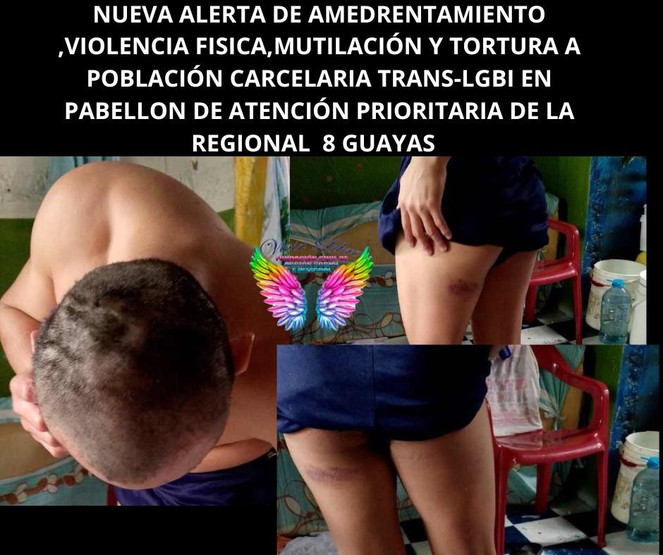 ksaTransEc's tweet photo. Nueva #alertaTrans en prisones nos matan y nadie dice nada!  @contraprisiones @ONU_es @ONUecuador @SNAI_Ec @DDHH_Ec @docubprisiones @AmnistiaOnline @CDHGYE @LaContraEc  @JusticiCarcelEc @AkilaDignidad @AsambleaEcuador @CorteIDH @DDHH_Alianza @eluniversocom https://t.co/G3kbeOq3x9