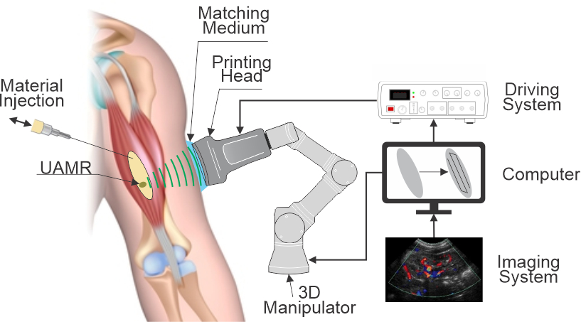 Direct Sound Printing, discovered by <a href="/ucdavis/">UC Davis</a> Assistant Prof. of Mechanical and Aerospace Engineering Mohsen Habibi, allows researchers to 3D print inside the human body to reduce the need for invasive surgeries. 

Read more: ow.ly/pUAR50STrwP

#UCDavisEngineering