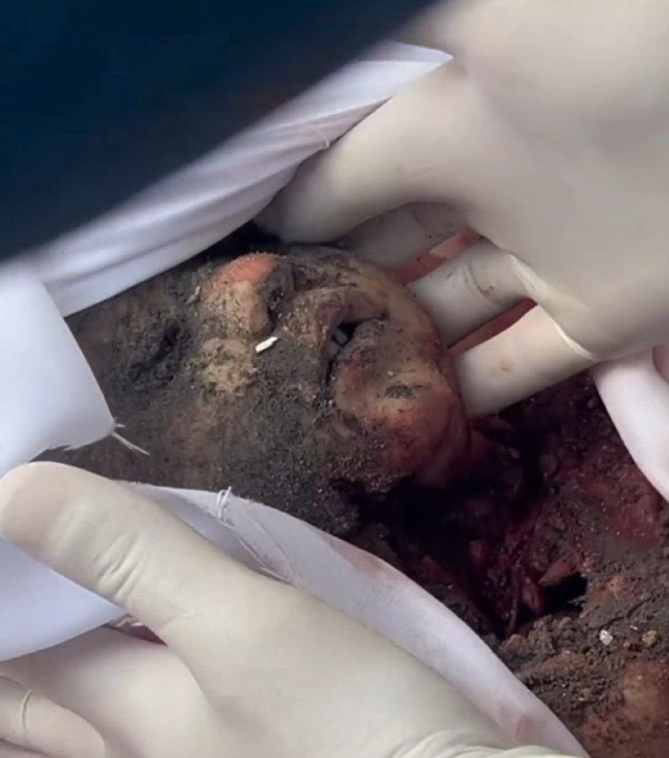 Gündemin değişmesine müsaade etmeyin !

Gazze’deki soykırım bir filim sahnesi değil !

GAZZE’Yİ UNUTMA, UNUTTURMA !