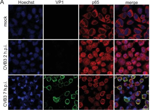 JVirology Editors (@jvirology) on Twitter photo #jvirology “Identification of the proteolytic signature in CVB3-infected cells” from Jan et al. <a href="/EricJanLab/">Eric Jan</a> <a href="/OverallLabNews/">The Overall Lab</a>. doi.org/10.1128/jvi.00… #jvirology “Identification of the proteolytic signature in CVB3-infected cells” from Jan et al. <a href="/EricJanLab/">Eric Jan</a> <a href="/OverallLabNews/">The Overall Lab</a>. doi.org/10.1128/jvi.00…