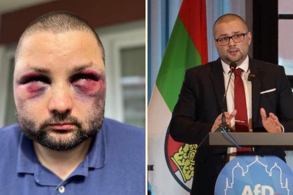 Sobre os ataques contra imigrantes no Reino Unido, me lembrei disto aqui: "Na Alemanha, o partido de inspiração neonazista AfD tem crescido pregando o ódio ao comunismo e aos imigrantes. Pois bem, Andreas Jurca, líder do partido, estava andando pela rua quando recebeu uma sessão