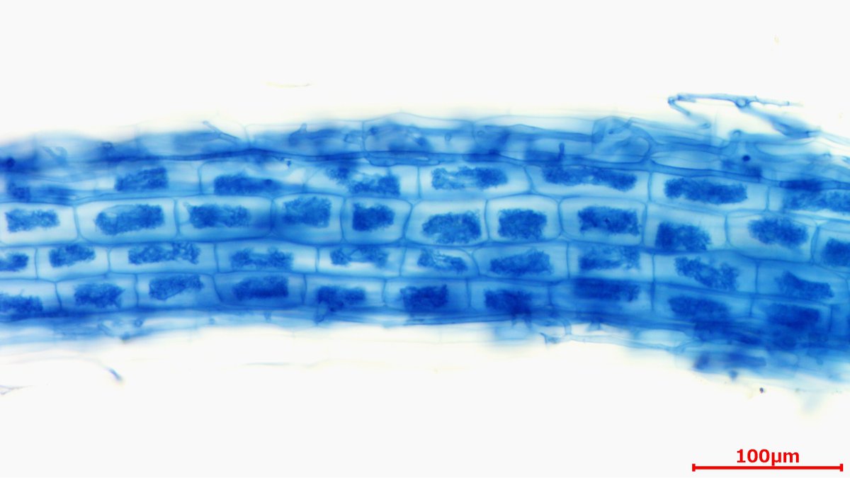 樹枝状体で満室な根
お盆休みの旅館みたいな感じ・・