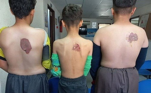 BehtarBehrokh's tweet photo. ظاهرا این کارگران نوجوان افغان توسط کارفرمای ایرانی شان شکنجه شدن.
به شما افتخار میکنم خوب افتخار آفرینی میکنید بنام ملت بزرگ ایران...
داعش را مردم منطقه فراموس خواهند کرد با دیدن این همه بربریت و سنگدلی که از آدرس یک تمدن بزرگ به همسایه تان روامیدارید https://t.co/ffryAwPbzQ