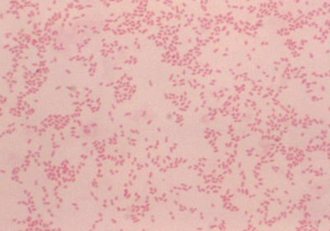 #idboardreview Few household members &amp; veterinary staff got exposed to a pregnant stray dog who later aborted puppies IFA +brucella canis &amp; pcr+vaginal secretions. 2 ppl had direct contact w/dog's placenta without PPE. What abx prophylaxis? #idxposts #idmeded #meded