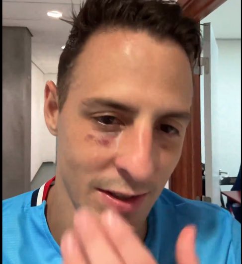 bellintanner's tweet image. CADE OS CHORAFOGUENSES AGORA? BOLSONARISTAS DA BOLA

BRIGARAM COM A IMAGEM E AGORA VÃO BRIGAR COM A LESÃO NO OLHO DE ARIAS? 

SUAS DESGRAÇAS CHORONAS DA DESGRAÇA

QUASE CEGARAM MEU JOGADOR E FALAM QUE FOI ROUBO, NANICOS