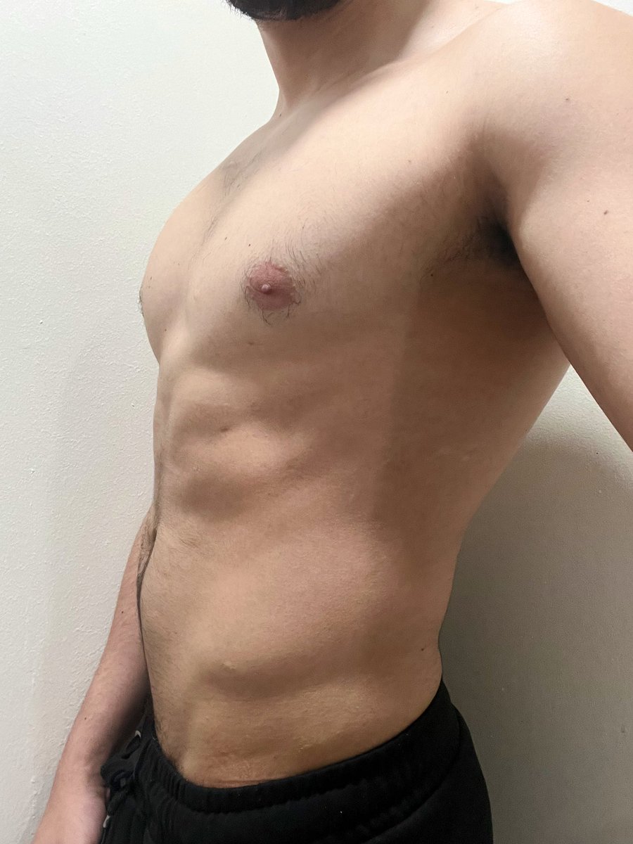 loaizing's tweet image. Solamente quería presumir mis teticas 🥹