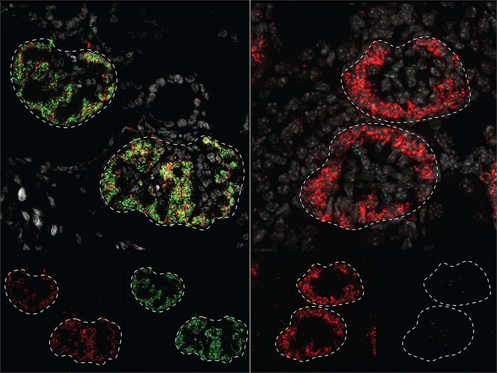 USC Stem Cell (@uscstemcell) on Twitter photo How similar is kidney development in humans and in lab mice that form the foundation of basic medical research? In a new study published in <a href="/Dev_Cell/">Developmental Cell</a>, <a href="/USCStemCell/">USC Stem Cell</a> scientists probe this question. <a href="/AndyMcMahonLab/">McMahon Lab</a> <a href="/LindstromLab/">Nils Lindstrom</a> <a href="/KeckSchool_USC/">Keck School of Medicine of USC</a> stemcell.keck.usc.edu/study-maps-how… How similar is kidney development in humans and in lab mice that form the foundation of basic medical research? In a new study published in <a href="/Dev_Cell/">Developmental Cell</a>, <a href="/USCStemCell/">USC Stem Cell</a> scientists probe this question. <a href="/AndyMcMahonLab/">McMahon Lab</a> <a href="/LindstromLab/">Nils Lindstrom</a> <a href="/KeckSchool_USC/">Keck School of Medicine of USC</a> stemcell.keck.usc.edu/study-maps-how…