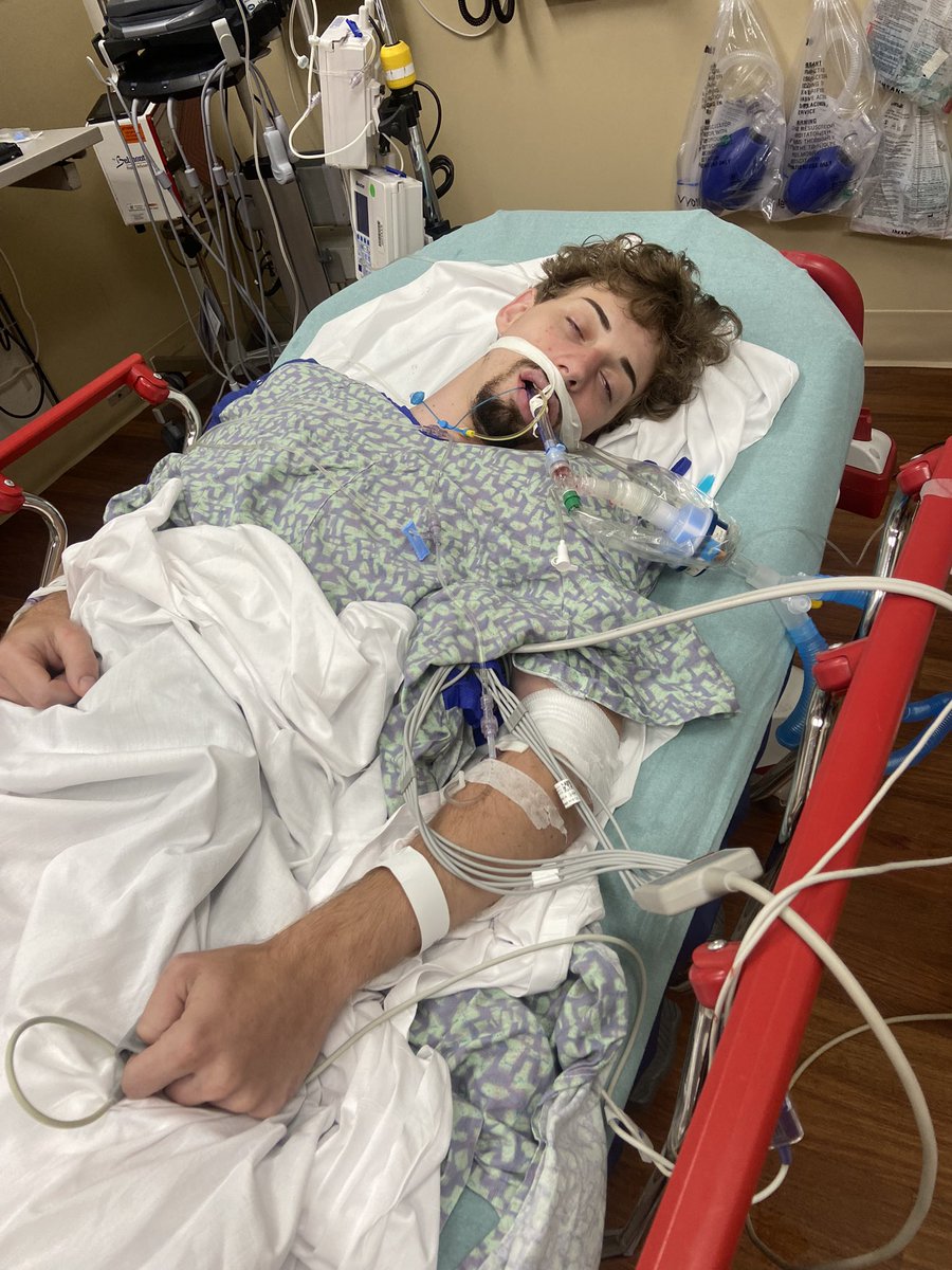 JohnJJannink's tweet photo. This is me literally 4 days after receiving the #pfizer #Covid #vaccine that was forced onto me to visit my family in the Netherlands. Never in my life had I had a seizure, nor any autoimmune disorders. I am now on multiple medications for epilepsy, inverse psoriasis, and https://t.co/aJo53JqdZR