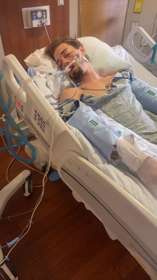 JohnJJannink's tweet photo. This is me literally 4 days after receiving the #pfizer #Covid #vaccine that was forced onto me to visit my family in the Netherlands. Never in my life had I had a seizure, nor any autoimmune disorders. I am now on multiple medications for epilepsy, inverse psoriasis, and https://t.co/aJo53JqdZR