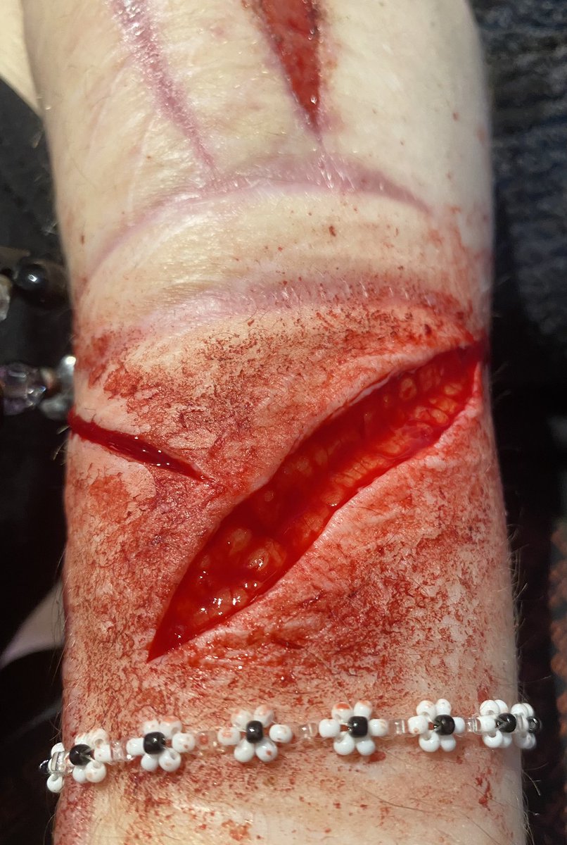 corpse_bunnyy's tweet photo. TW SHTWT https://t.co/4GW9SiXsfz