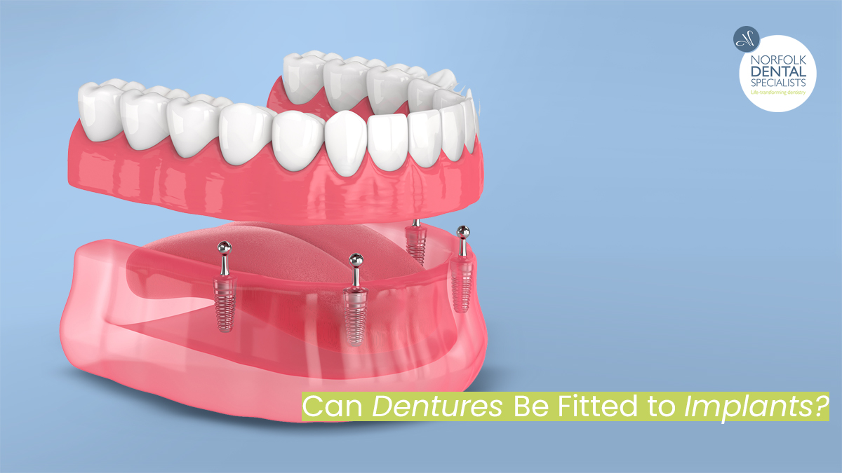 NorfolkDentalSpecialists tweet media