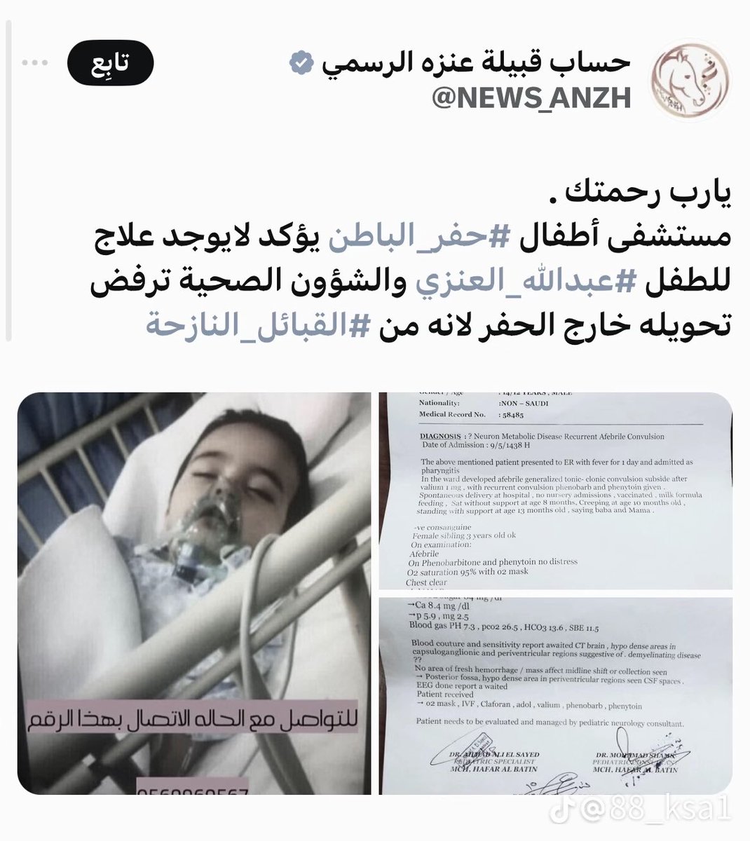 السالفة من 2017 وتوهم يتكلمون عنها والحين الكل صار عندهم بطايق ويتعالجون سواء بدون او لا
حدثني عن الهوس احدثك عن السعودية هههههههههههههههههههههههههههههه