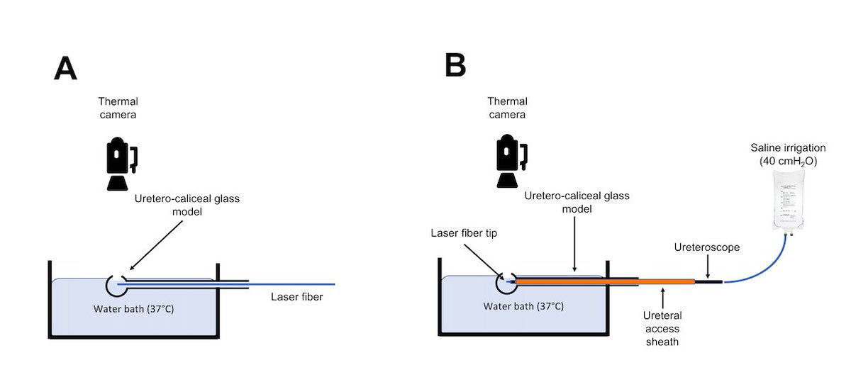DRobesti's tweet photo. 🔬 Our latest study dives into laser lithotripsy with a novel in-vitro setup to explore thermal effects. Using a glass pipette model of a renal calyx, we measured temperature changes and thermal doses under varied conditions. #UrologyResearch #MedicalInnovation https://t.co/Vsy5AIgBaf