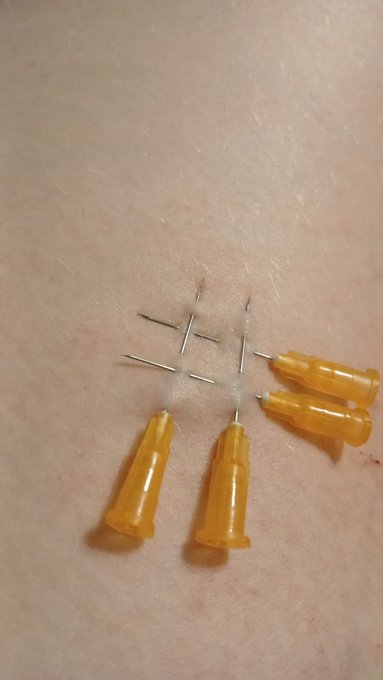 Just some self practice last night. https://t.co/RxFqqQXB36<a href="/tag/dallas"class="tags"><span>#dallas</span></a><a href="/tag/dfw"class="tags"><span>#dfw</span></a><a href="/tag/fortworth"class="tags"><span>#fortworth</span></a>