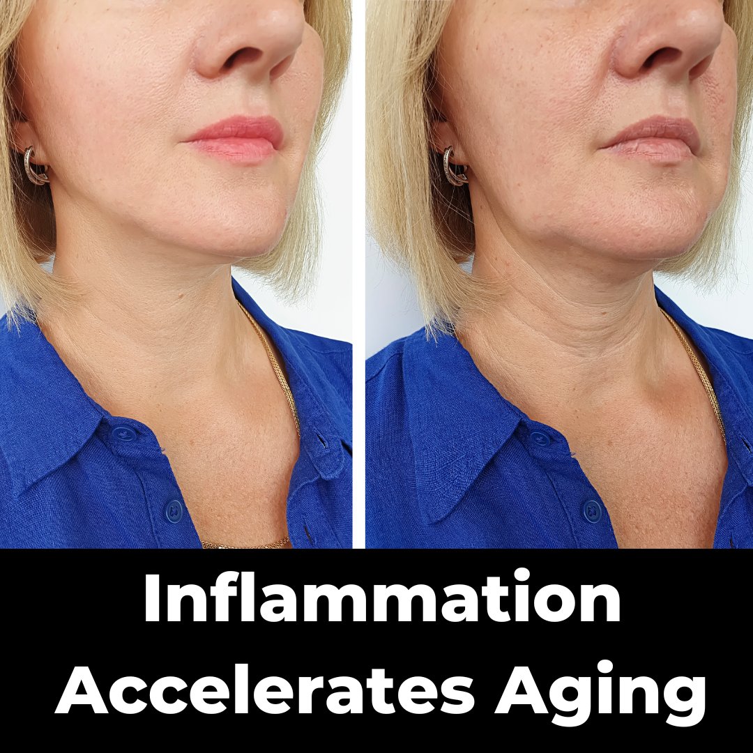 DrBPHealth's tweet photo. We cannot escape aging.

However, inflammation is a major accelerator of aging.

Lower your inflammation = slow down your aging

I will cover the tests that measure your inflammation levels to see where you stand.

THREAD https://t.co/rfxuA2rw6A
