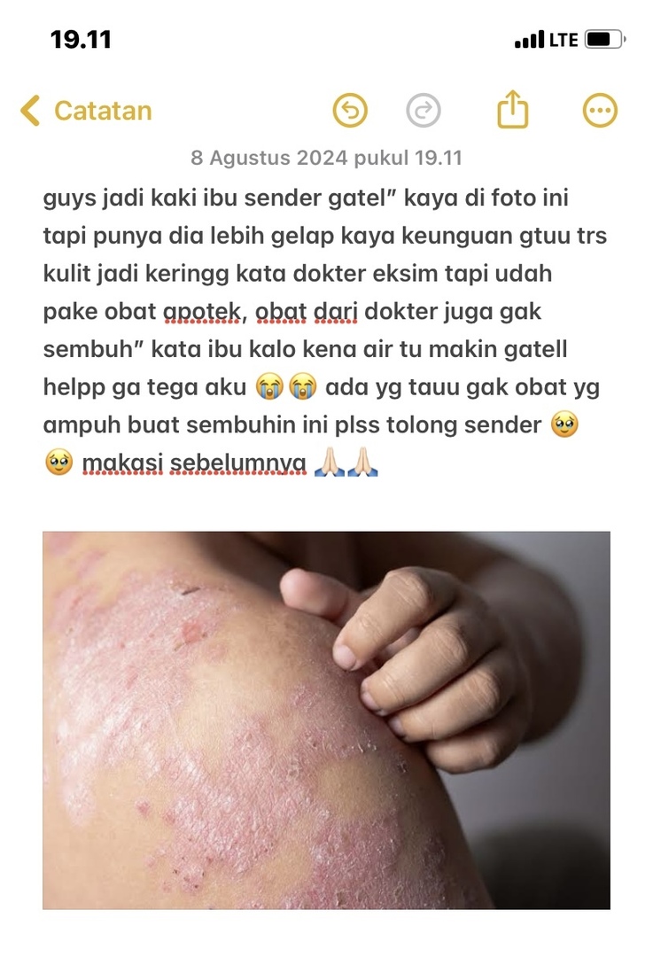 Tanyarlfes tweet media